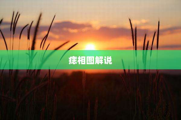 痣相图解说