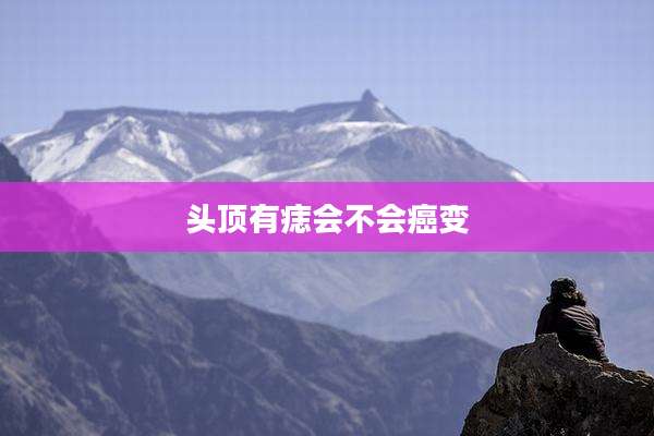 头顶有痣会不会癌变
